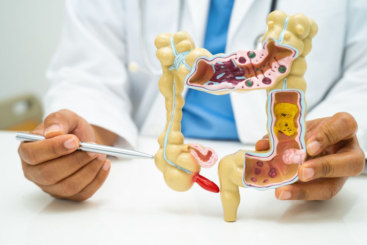 Dokter memegang model usus manusia