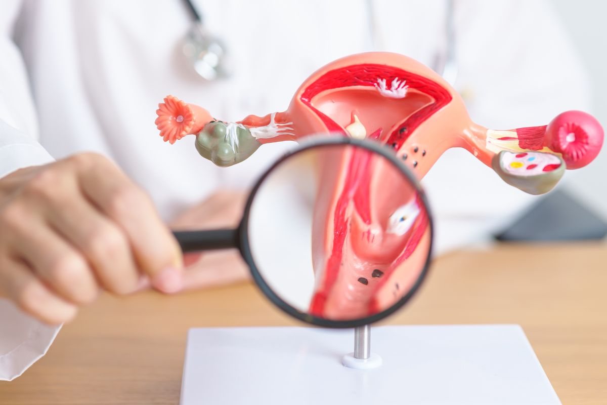 Dokter menunjukkan model kanker servik di vagina
