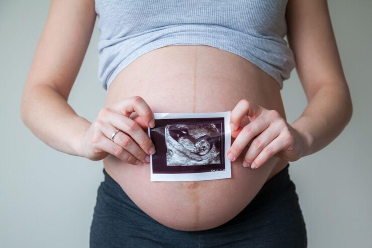 Close-up perut wanita hamil yang sedang memegang foto x-ray bayinya