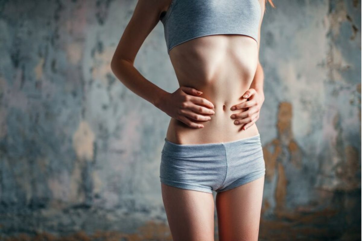 Perempuan dengan badan sangat kurus